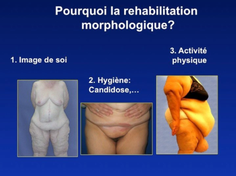 Chirurgie de réhabilitation cutanée