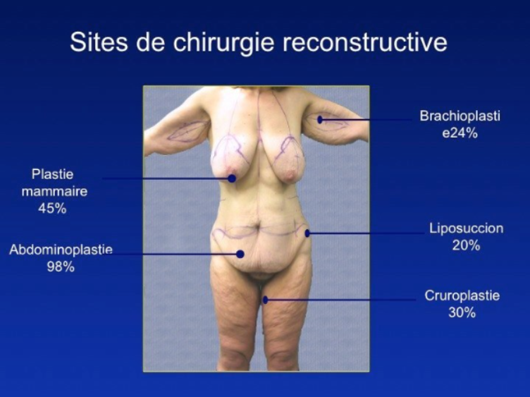 Chirurgie de réhabilitation cutanée 2